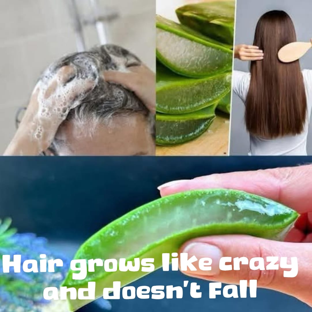 Hair Grows Like Crazy and Doesn’t Fall Out aloe vera 1