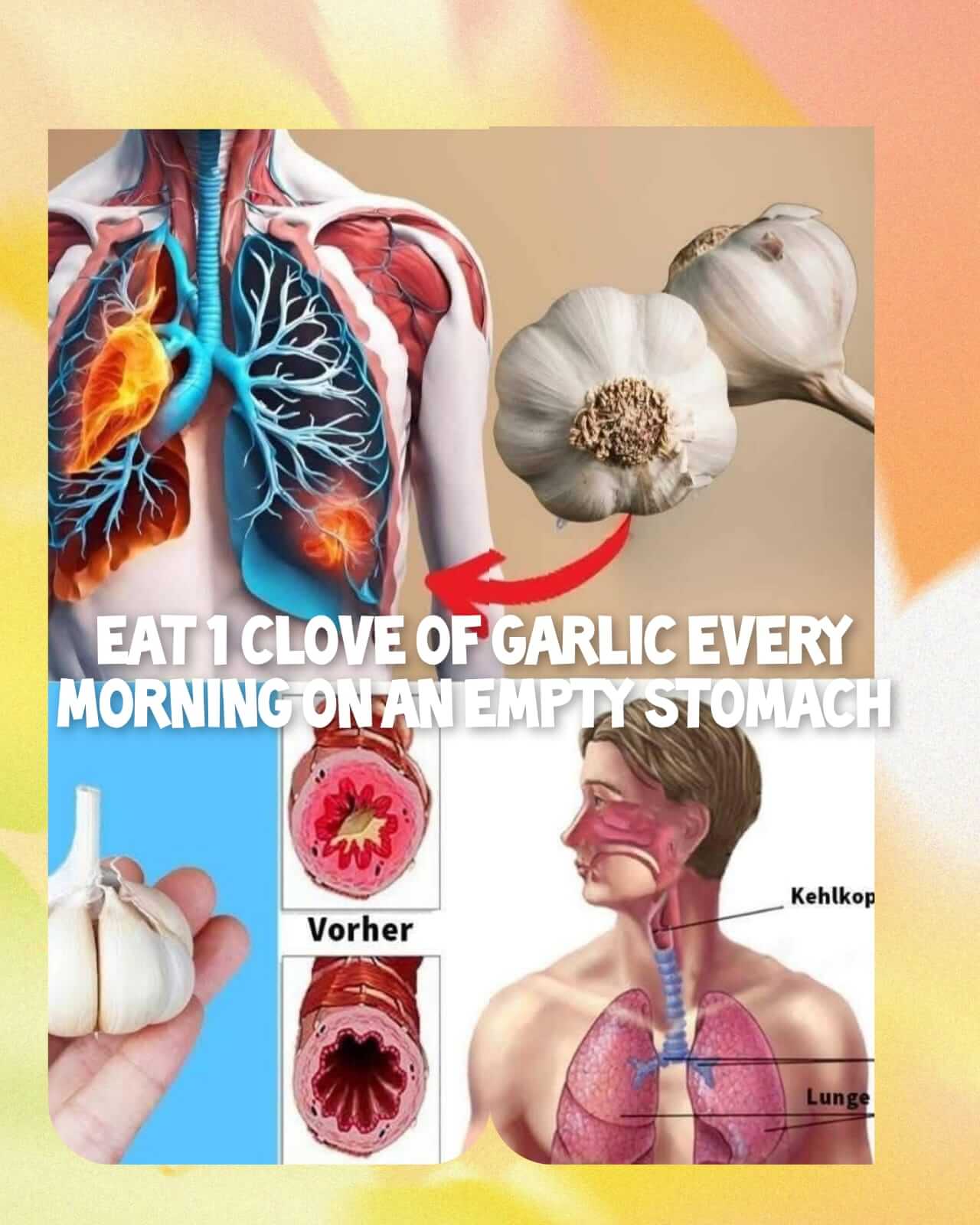 Eat one clove of garlic every morning on an empty stomach. 1