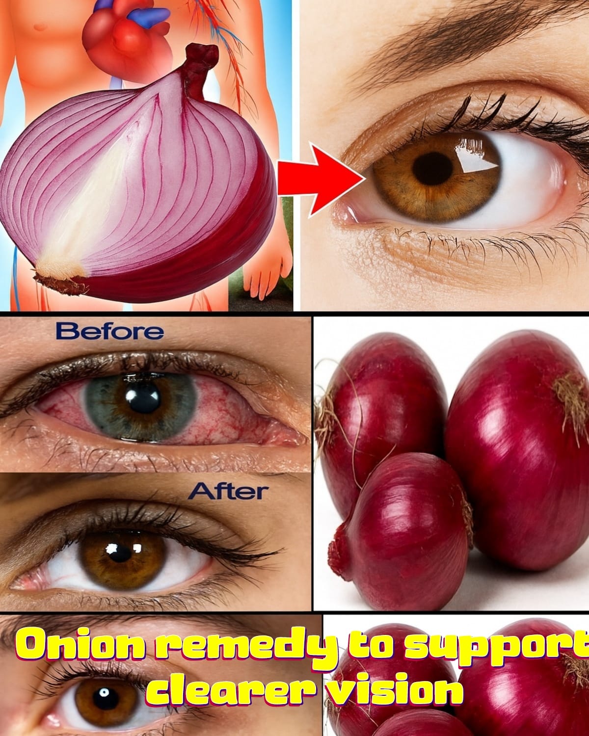 A Simple Onion Remedy to Support Clearer Vision at Home 1