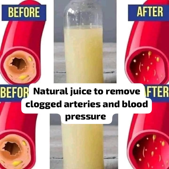 Natural Juice to Lower Blood Pressure and Clear Clogged Arteries 1