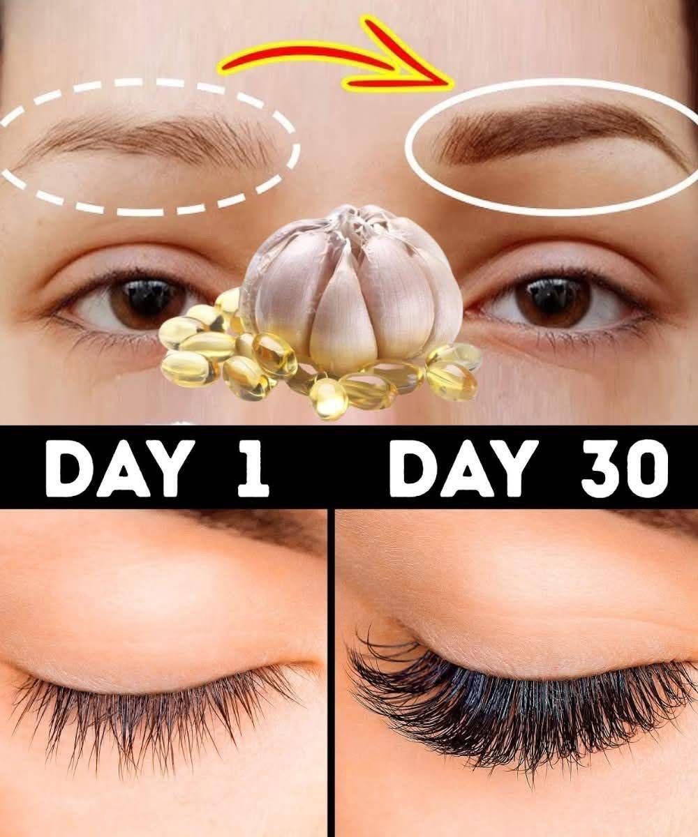 How to Use Vitamin E and Garlic to Naturally Grow Longer Eyelashes and Thicker Brows 1