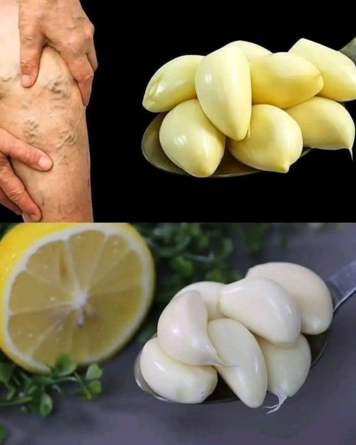 Natural Treatment for Swelling, Poor Circulation, and Varicose Veins 1