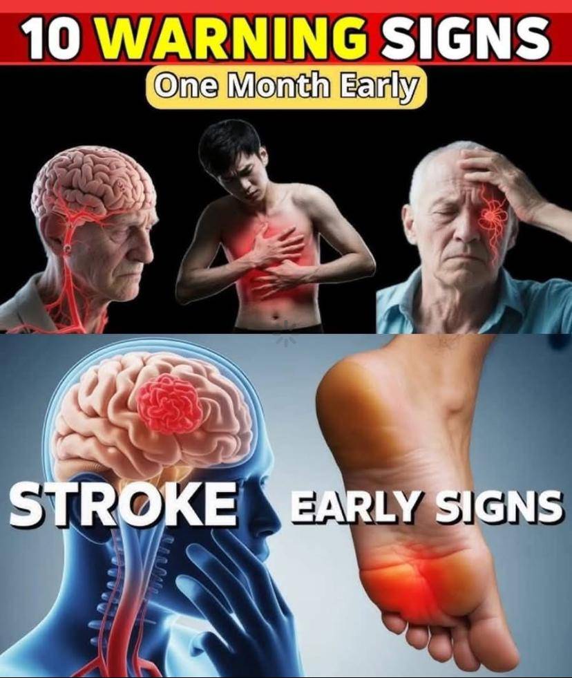 10 Warning Signs of Stroke One Month Before  1