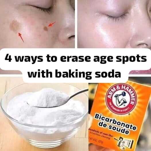 Four Baking Soda Methods to Remove Age Spots for Younger, More Even Skin 1