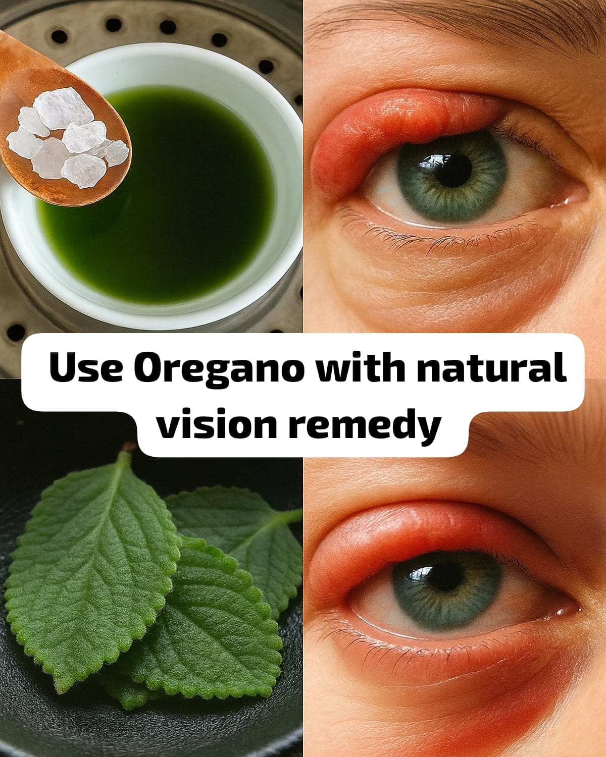 Oregano: The Natural Vision Remedy Taking Patients Away from Ophthalmologists 1