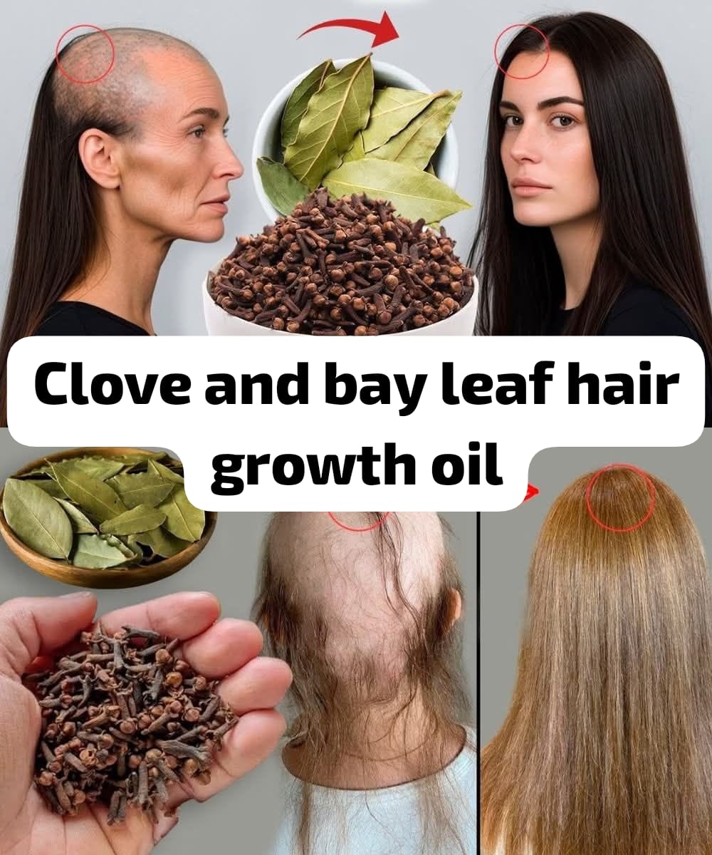 Bay Leaf and Clove Hair Growth Oil 1