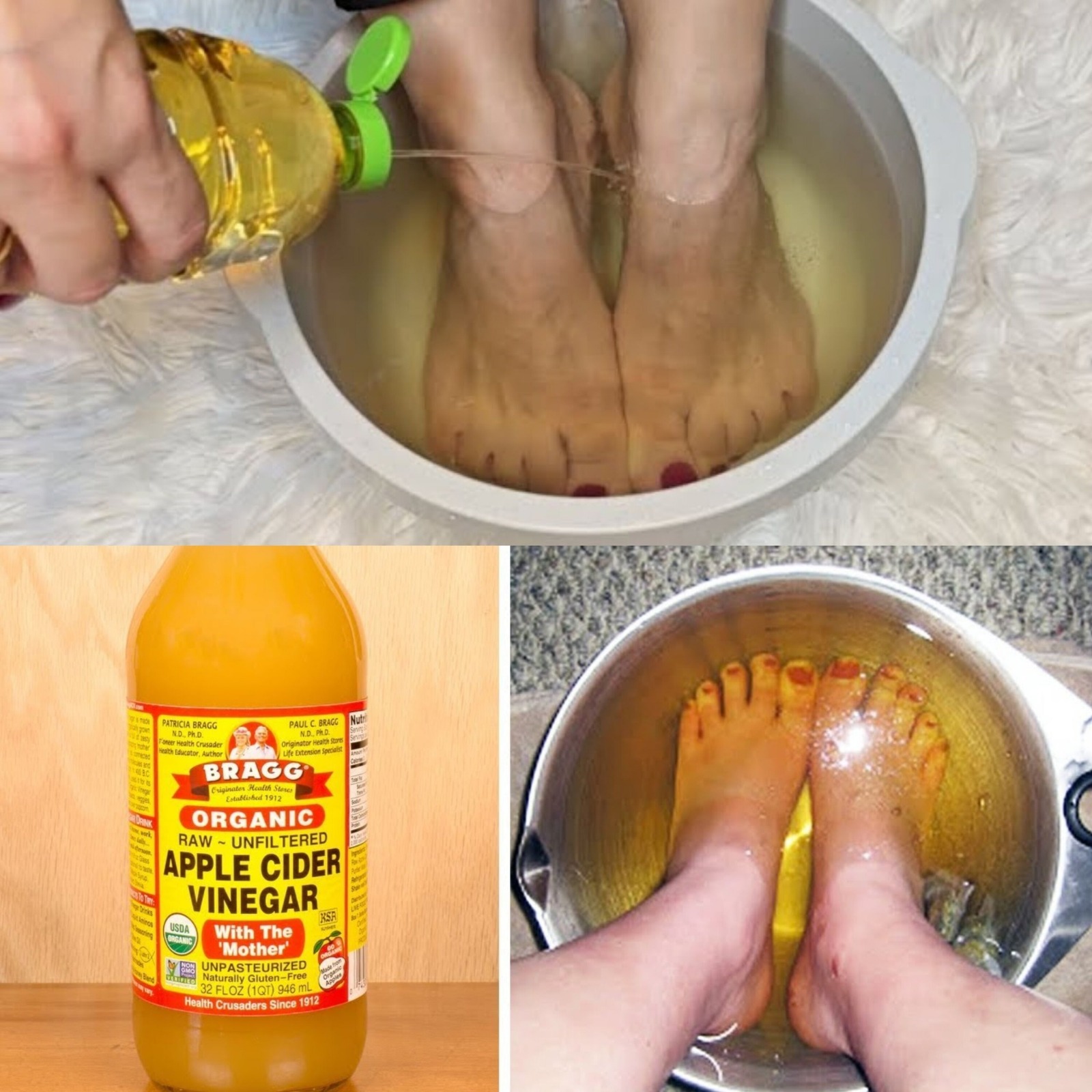 Soaked feet in apple cider vinegar and you will be shocked after fifteen minutes 1