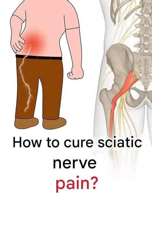 3 Exercises to Relieve Sciatica Pain in the Leg: Practical and Effective 1