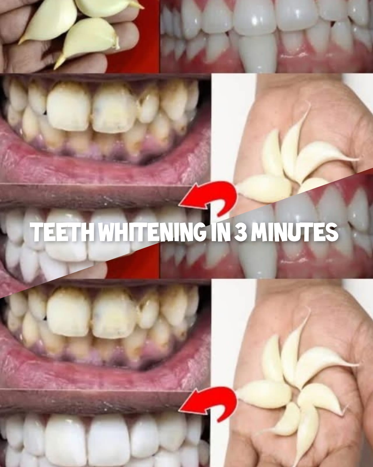 teeth Whitening at Home in 3 Minutes 1