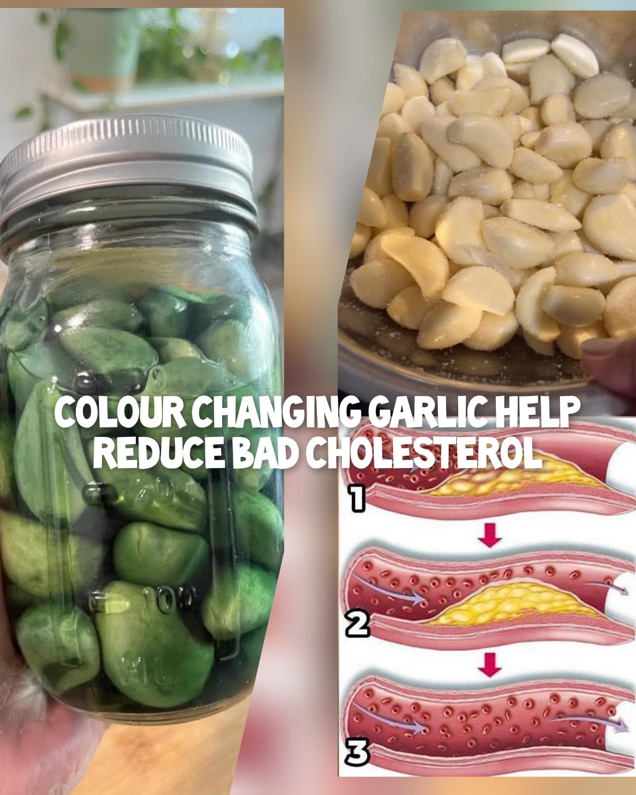 Laba Garlic The Color-Changing Garlic That May Help Reduce Bad Cholesterol 1