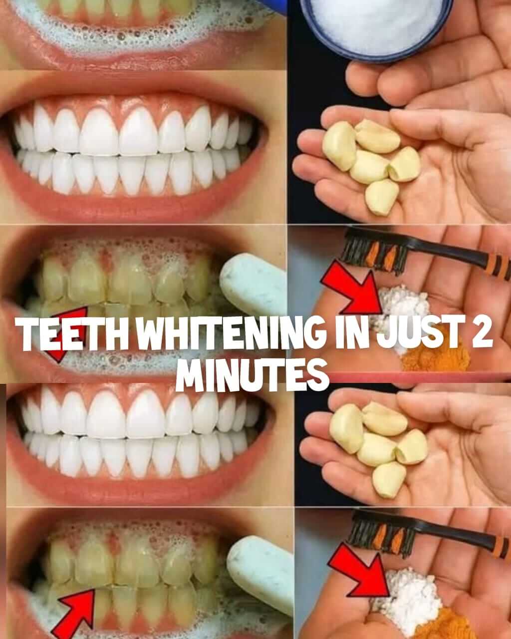 Teeth Whitening at Home in 2 Minutes 1